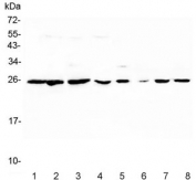 Western blot testing of 1) human placenta, 2) human PC-3, 3) human K562, 4) human HeLa, 5) rat lung, 6) rat liver, 7) mouse lung and 8) mouse liver lysate with Peroxiredoxin 6 antibody.  Expected molecular weight: ~25 kDa.