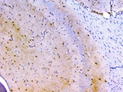 IHC staining of FFPE rat brain with Peroxiredoxin 6 antibody. HIER: boil tissue sections in pH6, 10mM citrate buffer, for 20 min and allow to cool before testing.