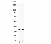 Western blot testing of PSCA antibody and Lane 1:  rat stomach;  2: mouse stomach;  Predicted size: 13KD;  Observed glycosylated size: up to 29KD