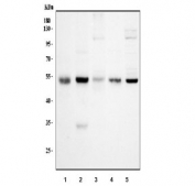 Western blot testing of 1) rat kidney, 2) rat lung, 3) rat testis, 4) mouse kidney and 5) mouse lung tissue lysate with Alpha 1 Antitrypsin antibody.  Expected molecular weight: ~47 kDa (unmodified), 52 kDa (glycosylated).
