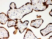 IHC-P: SERPINB2 antibody testing of human placenta tissue