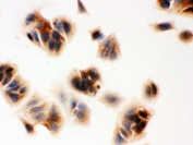 ICC testing of SERPINB5 antibody and MCF-7 cells.