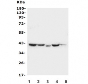 Western blot testing of 1) rat small intestine, 2) mouse small intestine, 3) human placenta, 4) human MDA-MB-231 and 5) human MCF7 lysate with SERPINB5 antibody.  Predicted molecular weight: 42~45 kDa.
