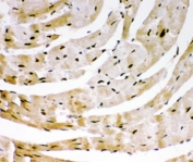 IHC-P: SIRT6 antibody testing of mouse heart tissue