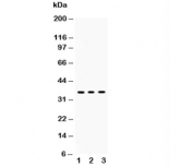 Western blot testing of SIRT6 antibody and Lane 1:  HeLa;  2: A549;  3: human placenta lysate