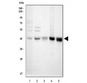 Western blot testing of 1) human 293T, 2) human HepG2, 3) rat spleen, 4) rat thymus and 5) mouse thymus lysate with SIRT7 antibody. Predicted molecular weight ~45 kDa.