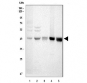 Western blot testing of 1) human 293T, 2) human HepG2, 3) rat spleen, 4) rat thymus and 5) mouse thymus lysate with SIRT7 antibody. Predicted molecular weight ~45 kDa.