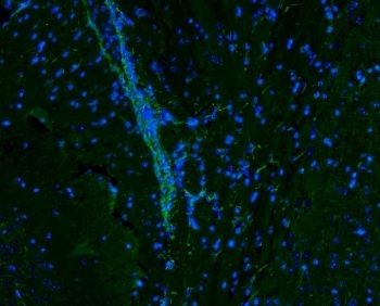Immunofluorescent staining of FFPE mouse brain tissue with Vimentin antibody (green) and DAPI nuclear stain (blue). HIER: boil tissue sections in pH8 EDTA for 20 min and allow to cool before testing.