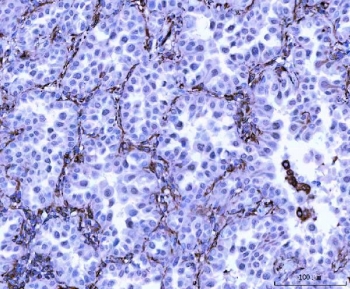 IHC staining of FFPE human tonsil tissue with Vimentin antibody. HIER: boil tissue sections in pH8 EDTA for 20 min and allow to cool before testing.