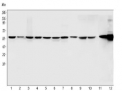 Western blot testing of 1) human placenta, 2) human U-87 MG, 3) human U-2 OS, 4) human PC-3, 5) human HeLa, 6) human ThP-1, 7) human A549, 8) human MCF7, 9) rat ovary, 10) rat lung, 11) mouse lung and 12) mouse NIH 3T3 cell lysate with Vimentin antibody. Predicted molecular weight ~54 kDa.