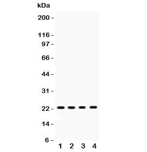 Western blot testing of RBP4 antibody and Lane 1: rat liver; 2: mouse liver; 3: human HEPG2; 4: (h) COLO320 lysate. Predicted/observed size ~23KD