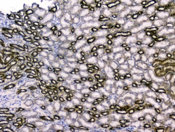 IHC staining of FFPE mouse kidney with RBP4 antibody. HIER: boil tissue sections in pH6, 10mM citrate buffer, for 20 min and allow to cool before testing.