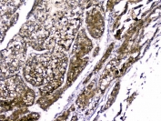 IHC staining of FFPE mouse kidney with RBP4 antibody. HIER: boil tissue sections in pH6, 10mM citrate buffer, for 20 min and allow to cool before testing.
