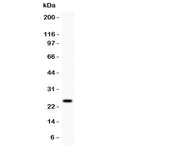 Western blot testing of Prolactin antibody and MCF7 lysate. Predicted/observed size ~25KD