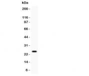 Western blot testing of Prolactin antibody and MCF7 lysate.  Predicted/observed molecular weight: ~25kDa.