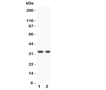 Western blot testing of SFRP2 antibody and 1. COLO320, 2. SW620 lysate. Predicted/observed size ~33KD