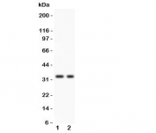 Western blot testing of SFRP2 antibody and 1. COLO320, 2. SW620 lysate.  Predicted/observed molecular weight: ~33kDa.