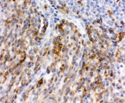 IHC-P: P-Selectin antibody testing of human tonsil tissue. HIER: steamed with pH6 citrate buffer.