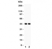 Western blot testing of RUNX3 antibody and human lysates 1. A431 and 2. U-2 0S. Predicted molecular weight: ~44 kDa, isoforms can be observed at 42-48 kDa.
