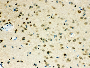 IHC staining of FFPE mouse brain tissue with VCP antibody. HIER: boil tissue sections in pH8 EDTA for 20 min and allow to cool before testing.