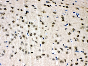 IHC staining of FFPE rat brain tissue with VCP antibody. HIER: boil tissue sections in pH8 EDTA for 20 min and allow to cool before testing.