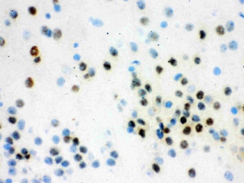 IHC staining of frozen mouse brain tissue with VCP antibody.