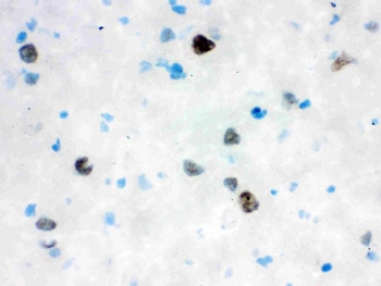 IHC staining of frozen rat brain tissue with VCP antibody.