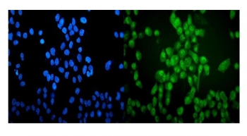 Immunofluorescent staining of FFPE human A431 cells with VCP antibody (green) and DAPI nuclear stain (blue). HIER: steam section in pH6 citrate buffer for 20 min.