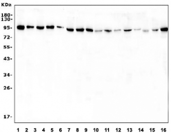 Western blot testing of human 1) HeLa, 2) A431, 3) U-87 MG, 4) A549, 5) SH-SY5Y, 6) K562, 7) Raji, 8) HepG2 and rat 9) heart, 10) spleen, 11) kidney, 12) liver and mouse 13) heart, 14) kidney, 15) liver and 16) HEPA1-6 cell lysate with VCP antibody. Predicted molecular weight ~89 kDa.