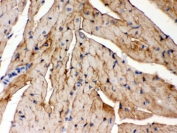 IHC testing of FFPE mouse heart with FXYD1 antibody. HIER: Boil the paraffin sections in pH 6, 10mM citrate buffer for 20 minutes and allow to cool prior to staining.