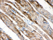 IHC testing of FFPE rat heart with FXYD1 antibody. HIER: Boil the paraffin sections in pH 6, 10mM citrate buffer for 20 minutes and allow to cool prior to staining.