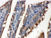 IHC testing of FFPE rat intestine with SULT2B1 antibody. HIER: Boil the paraffin sections in pH 6, 10mM citrate buffer for 20 minutes and allow to cool prior to staining.