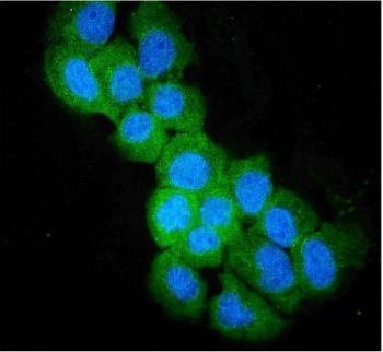 Immunofluorescent staining of FFPE human A431 cells with SULT2B1 antibody (green) and DAPI nuclear stain (blue). HIER: steam section in pH6 citrate buffer for 20 min.