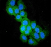 Immunofluorescent staining of FFPE human A431 cells with SULT2B1 antibody (green) and DAPI nuclear stain (blue). HIER: steam section in pH6 citrate buffer for 20 min.