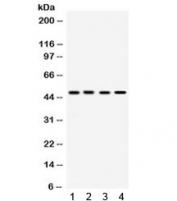 Western blot testing of 1) rat testis, 2) human A431, 3) human HeLa and 4) human MCF7 lysate with SULT2B1 antibody. Predicted molecular weight 39-41 kDa but routinely observed at 41-48 kDa.