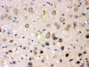 IHC testing of FFPE mouse brain with FE65 antibody. HIER: Boil the paraffin sections in pH 6, 10mM citrate buffer for 20 minutes and allow to cool prior to staining.