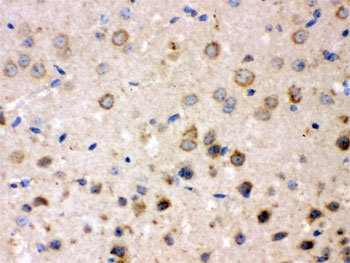 IHC testing of FFPE mouse brain with FE65 antibody. HIER: Boil the paraffin sections in pH 6, 10mM citrate buffer for 20 minutes and allow to cool prior to staining.