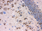 IHC testing of FFPE rat brain with FE65 antibody. HIER: Boil the paraffin sections in pH 6, 10mM citrate buffer for 20 minutes and allow to cool prior to staining.