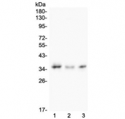 Western blot testing of 1) human COLO-320, 2) rat testis and 3) mouse Neuro-2A lysate with Galectin 8 antibody. Expected molecular weight ~36/40 kDa (isoforms 1/2).