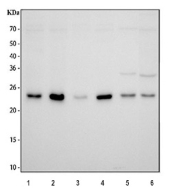 Western blot testing of 1) human HeLa, 2) human 293T, 3) human Jurkat, 4) human U-251, 5) rat liver and 6) mouse liver tissue lysate with PGRMC1 antibody. Expected molecular weight ~22 kDa.