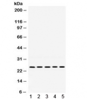 Western blot testing of 1) rat liver, 2) rat kidney, 3) mouse liver, 4) mouse kidney and 5) human SMMC lysate with PGRMC1 antibody. Expected molecular weight ~22 kDa.