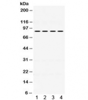 Western blot testing of human 1) HeLa, 2) 22RV1, 3) MCF7 and 4) SW620 cell lysate with PIK3R2 antibody. Expected/observed molecular weight ~85 kDa.