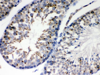 IHC testing of FFPE mouse testis with EBAG9 antibody. HIER: Boil the paraffin sections in pH 6, 10mM citrate buffer for 20 minutes and allow to cool prior to staining.