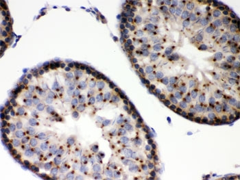 IHC testing of FFPE rat testis with EBAG9 antibody. HIER: Boil the paraffin sections in pH 6, 10mM citrate buffer for 20 minutes and allow to cool prior to staining.