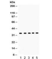 Western blot testing of 1) rat testis, 2) human 22RV1, 3) HeLa, 4) MCF7, and 5) Jurkat lysate with EBAG9 antibody. Predicted molecular weight: ~25/29-34 kDa (isoform 1/2).