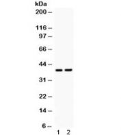 Western blot testing of 1) rat brain and 2 mouse NIH3T3 lysate with SOX1 antibody.  Predicted/observed molecular weight ~39 kDa.