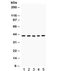 Western blot testing of 1) rat thymus, 2) rat skeletal muscle, 3) human A431, 4) SGC, 5) 22RV1 lysate with CCN1 antibody. Predicted/observed molecular weight ~42 kDa.