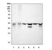 Western blot testing of 1) human HCCT, 2) human HCCP, 3) rat kidney, 4) rat liver, 5) mouse kidney and 6) mouse liver tissue lysate with WNT7A antibody. Expected molecular weight ~39 kDa.