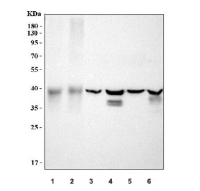 Western blot testing of 1) human HCCT, 2) human HCCP, 3) rat kidney, 4) ra