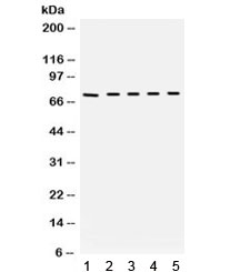 Western blot testing of mouse 1) lung, 2) testis, 3) liver, 4) HEPA and 5) NEURO lysate with Bradykinin antibody. Expected/observed molecular weight ~72 kDa.~